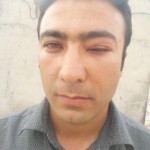 از ضرب و شتم مدافع حرم توسط پزشک اورژانس رامهرمز و ضرب و شتم جانباز ۵۵درصد در شبکه بهداشت/گفت وگوی یاران۳۱۳ با مدافع حرم و جانباز و فریاد های عجیب و شبیه پزشک اورژانس و رئیس شبکه بهداشت!